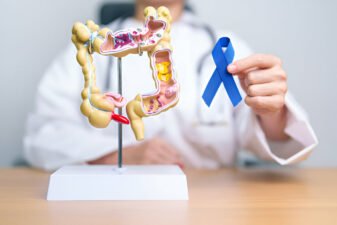 Colorectal Cancer