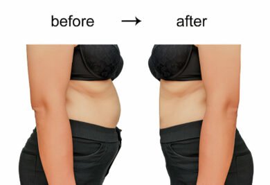 Waist-Hip Ratio