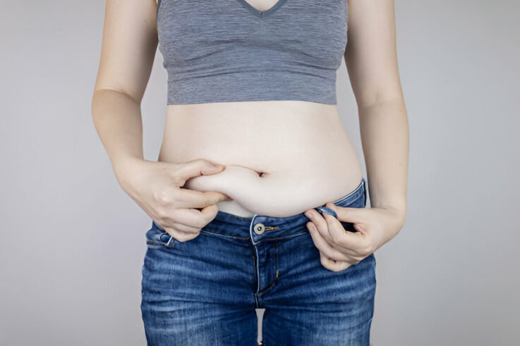 Weight Loss Surgery Results